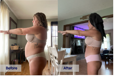Sunlight GLP-1 semaglutide before and after weight loss – Kelsey B. lost 33 lbs