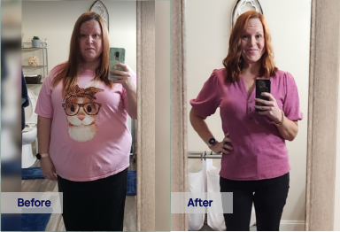 Sunlight GLP-1 semaglutide before and after weight loss – Sarah M. lost 100 lbs