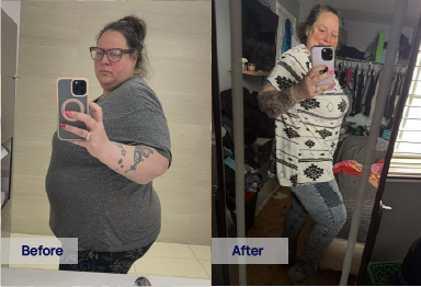 Sunlight GLP-1 semaglutide before and after weight loss – Gabrielle R. lost 71 lbs