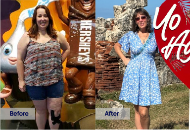 Sunlight GLP-1 semaglutide before and after weight loss – Tammy T. lost 112 lbs