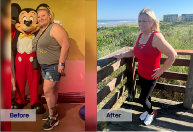Sunlight GLP-1 semaglutide before and after weight loss – Brooke B. lost 91 lbs